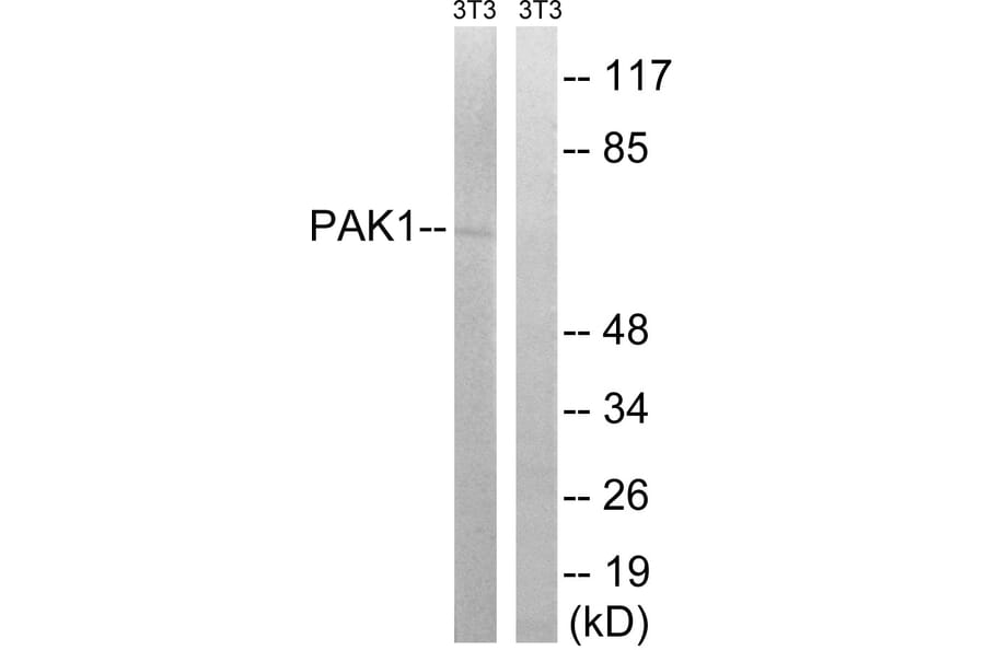 Western Blot - Anti-PAK1 Antibody (B8158) - Antibodies.com