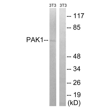 Western Blot - Anti-PAK1 Antibody (B8158) - Antibodies.com