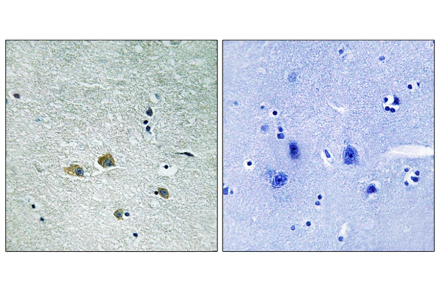 Immunohistochemistry - Anti-PAK1 Antibody (B8158) - Antibodies.com