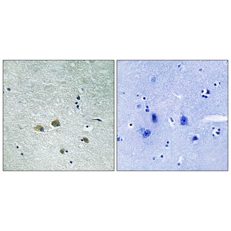 Immunohistochemistry - Anti-PAK1 Antibody (B8158) - Antibodies.com