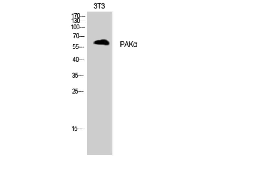 Western Blot - Anti-PAK1 Antibody (B8158) - Antibodies.com