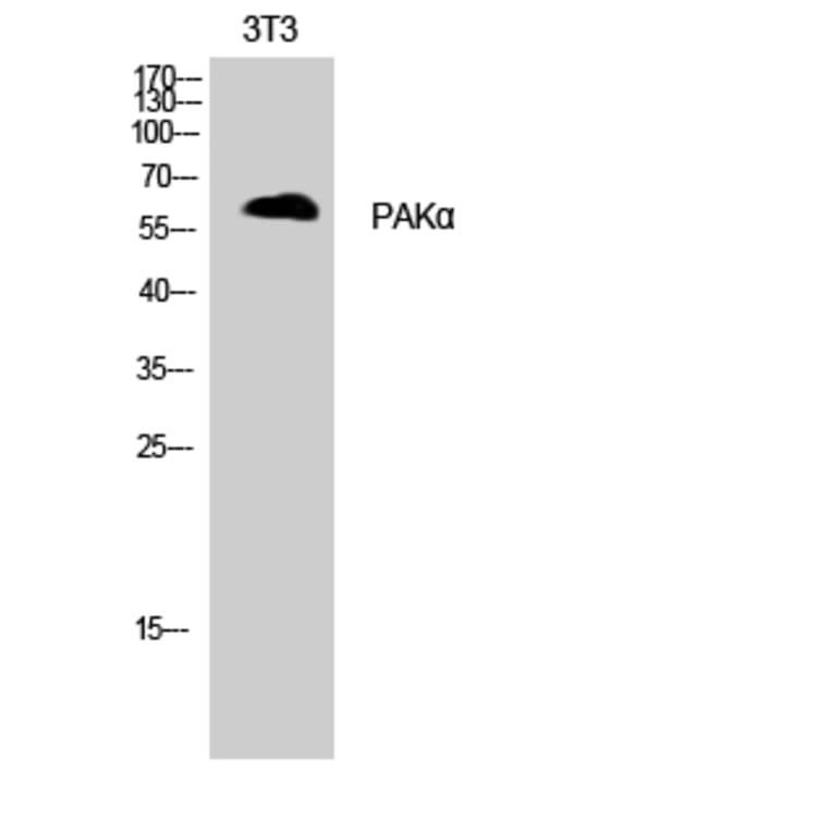 Western Blot - Anti-PAK1 Antibody (B8158) - Antibodies.com