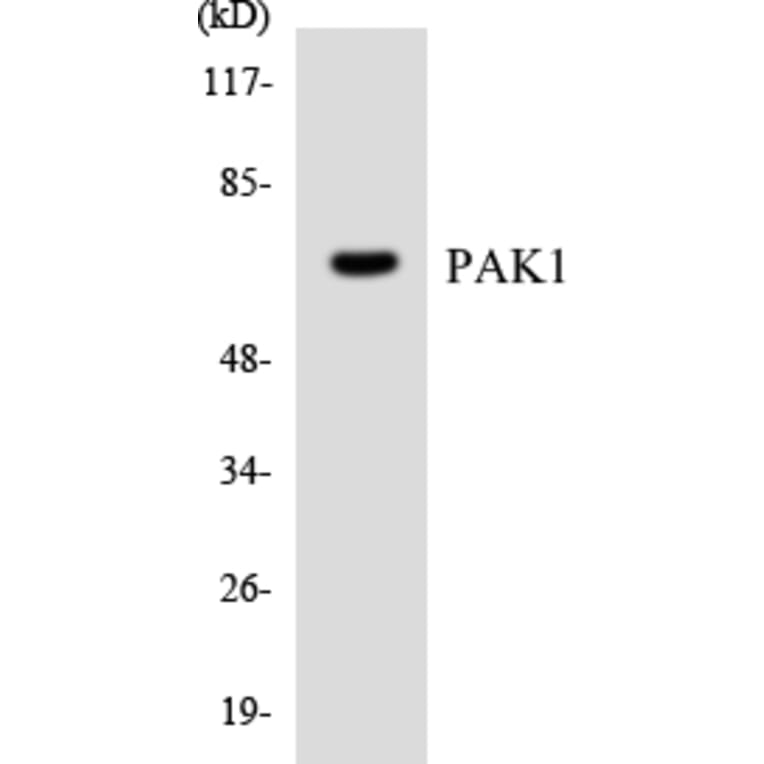 Western Blot - Anti-PAK1 Antibody (R12-3296) - Antibodies.com