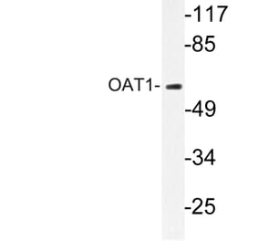 Western Blot - Anti-OAT1 Antibody (R12-2277) - Antibodies.com