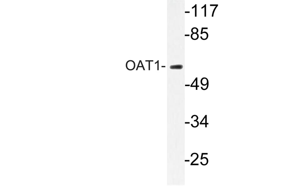 Western Blot - Anti-OAT1 Antibody (R12-2277) - Antibodies.com