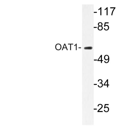 Western Blot - Anti-OAT1 Antibody (R12-2277) - Antibodies.com
