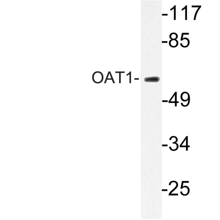 Western Blot - Anti-OAT1 Antibody (R12-2277) - Antibodies.com