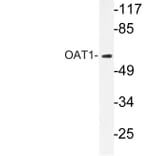 Western Blot - Anti-OAT1 Antibody (R12-2277) - Antibodies.com