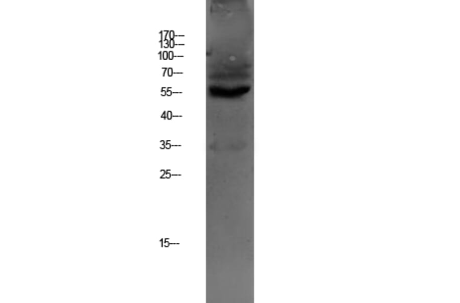 Western Blot - Anti-OAT1 Antibody (R12-2277) - Antibodies.com