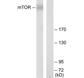 Western Blot - Anti-mTOR Antibody (B7156) - Antibodies.com