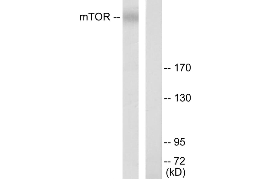 Western Blot - Anti-mTOR Antibody (B7156) - Antibodies.com
