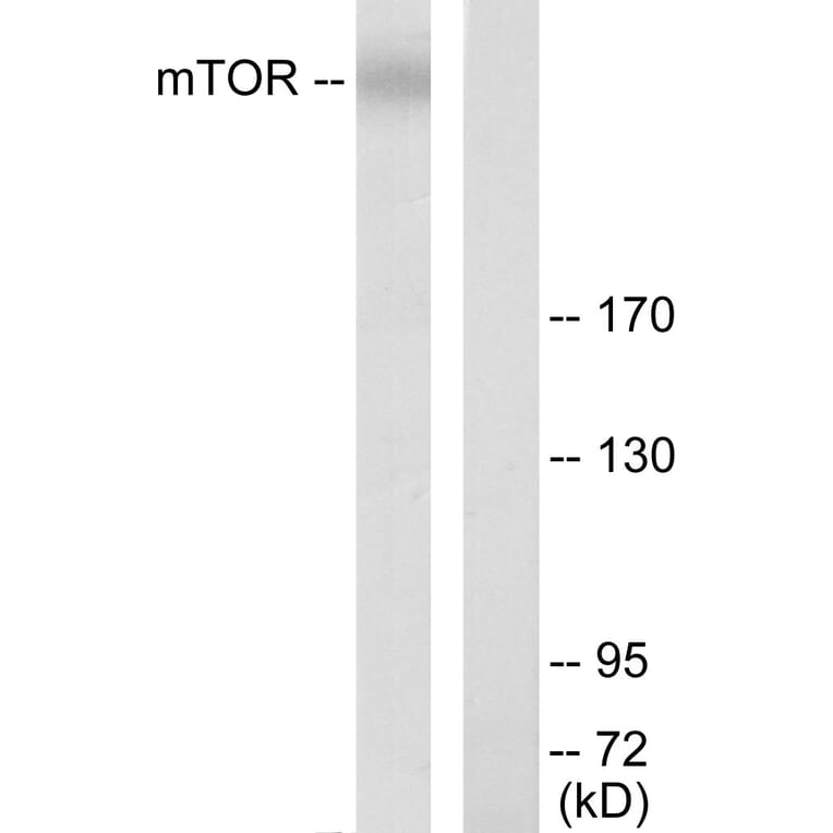 Western Blot - Anti-mTOR Antibody (B7156) - Antibodies.com