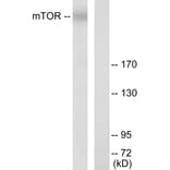 Western Blot - Anti-mTOR Antibody (B7156) - Antibodies.com