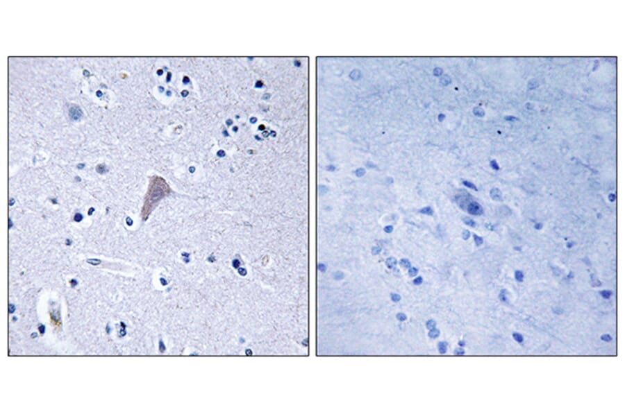 Immunohistochemistry - Anti-mTOR Antibody (B7156) - Antibodies.com