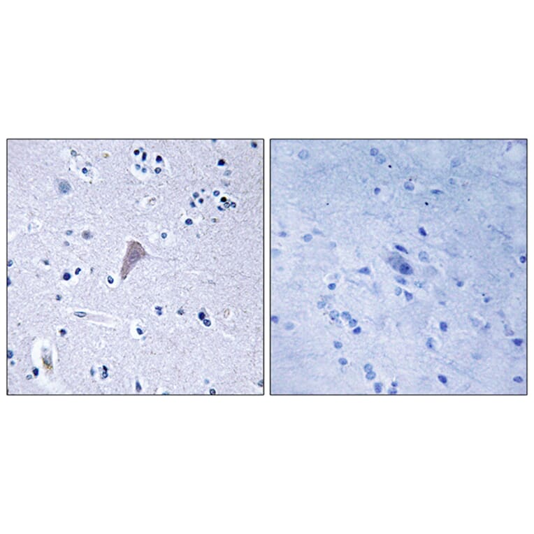 Immunohistochemistry - Anti-mTOR Antibody (B7156) - Antibodies.com