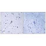 Immunohistochemistry - Anti-mTOR Antibody (B7156) - Antibodies.com