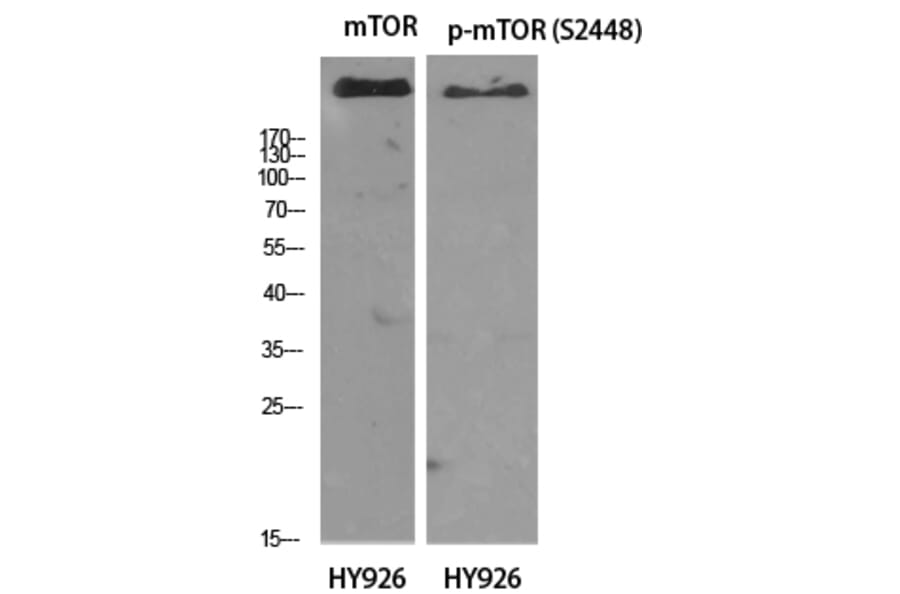Western Blot - Anti-mTOR Antibody (B7156) - Antibodies.com