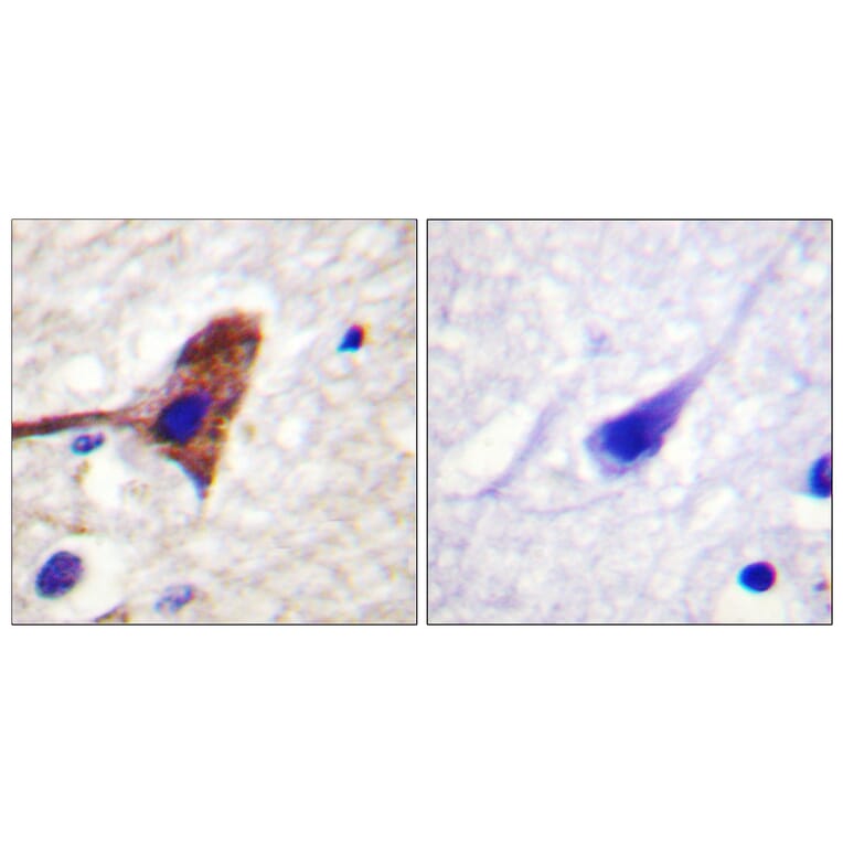 Immunohistochemistry - Anti-mTOR Antibody (B0688) - Antibodies.com