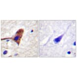 Immunohistochemistry - Anti-mTOR Antibody (B0688) - Antibodies.com