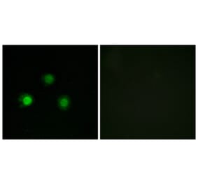Immunofluorescence - Anti-MSH2 Antibody (C13089) - Antibodies.com