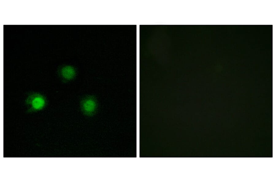 Immunofluorescence - Anti-MSH2 Antibody (C13089) - Antibodies.com