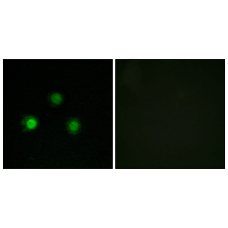 Immunofluorescence - Anti-MSH2 Antibody (C13089) - Antibodies.com