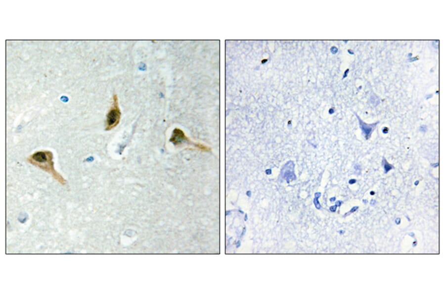 Immunohistochemistry - Anti-MSH2 Antibody (C13089) - Antibodies.com