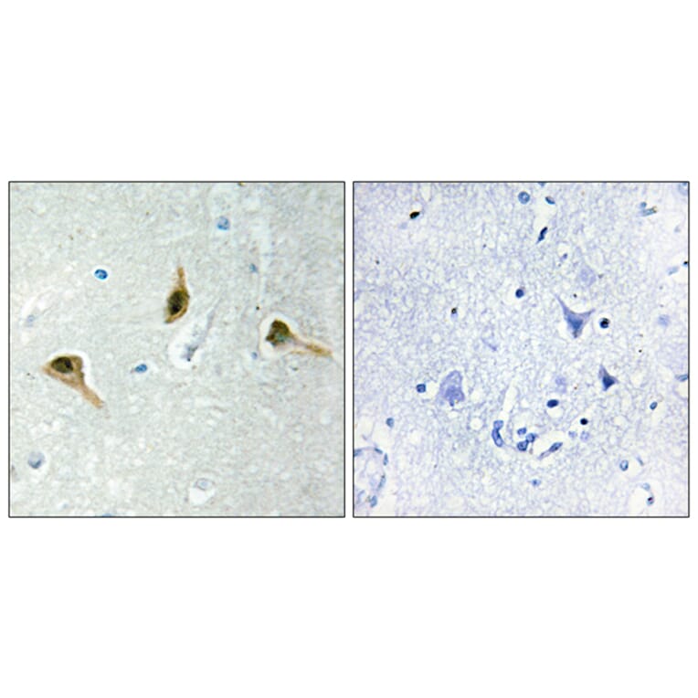 Immunohistochemistry - Anti-MSH2 Antibody (C13089) - Antibodies.com