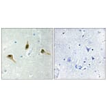 Immunohistochemistry - Anti-MSH2 Antibody (C13089) - Antibodies.com