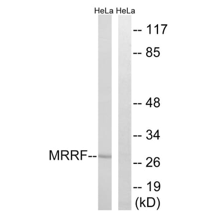 Western Blot - Anti-MRRF Antibody (C18437) - Antibodies.com