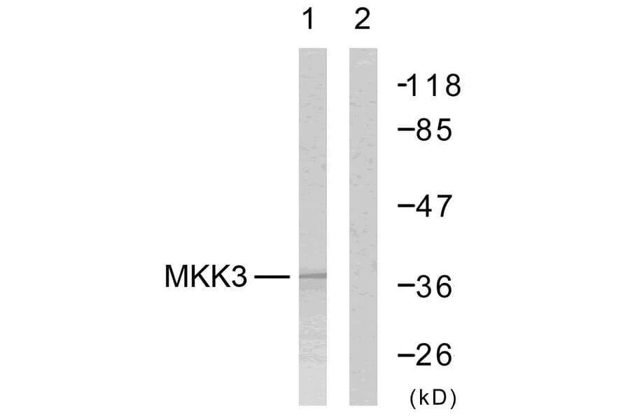 Western Blot - Anti-MKK6 Antibody (B7154) - Antibodies.com