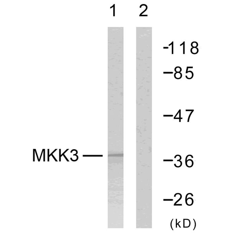 Western Blot - Anti-MKK6 Antibody (B7154) - Antibodies.com