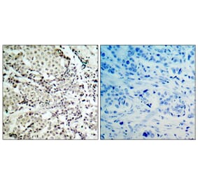 Immunohistochemistry - Anti-MKK3 Antibody (B7153) - Antibodies.com