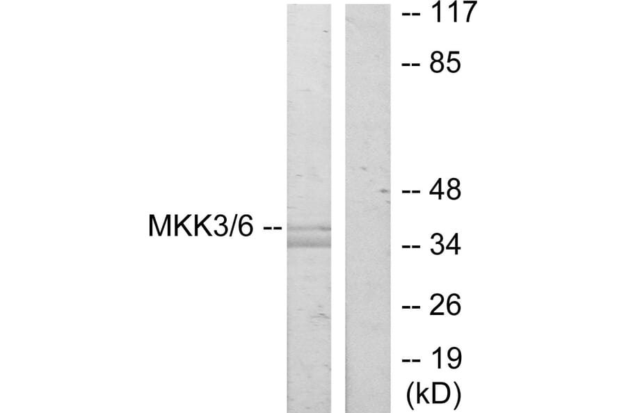 Western Blot - Anti-MKK3 Antibody (B7153) - Antibodies.com