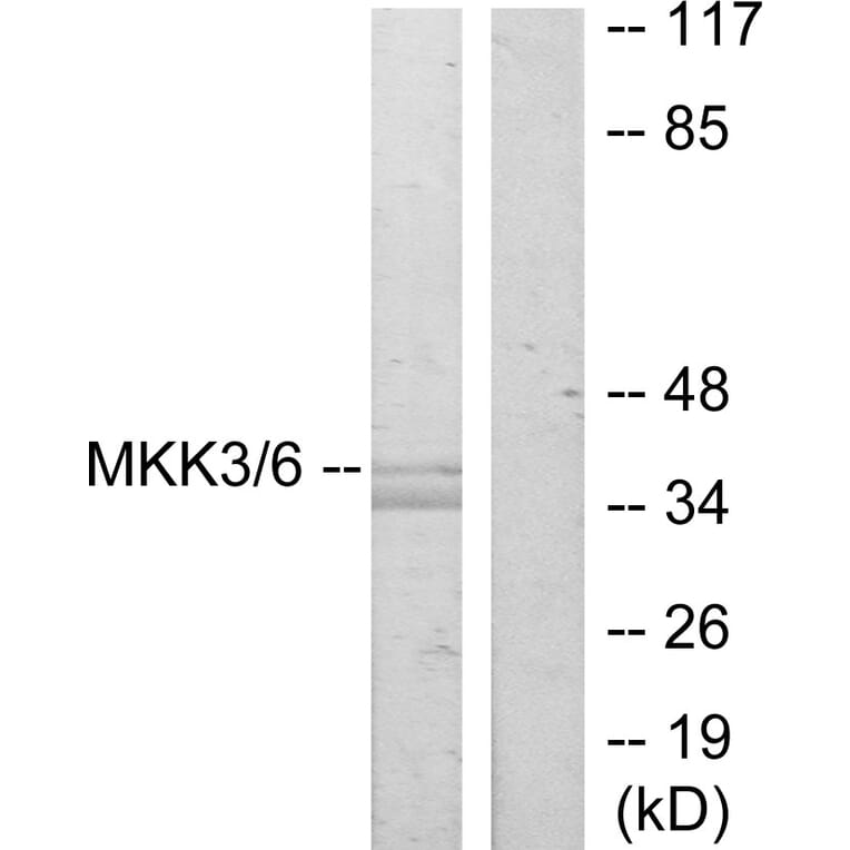 Western Blot - Anti-MKK3 Antibody (B7153) - Antibodies.com