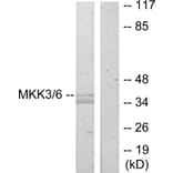 Western Blot - Anti-MKK3 Antibody (B7153) - Antibodies.com