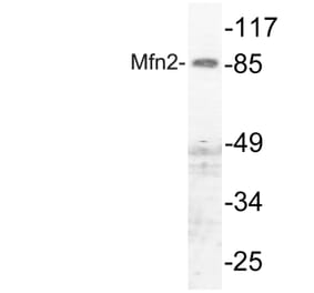 Western Blot - Anti-Mfn2 Antibody (R12-2237) - Antibodies.com
