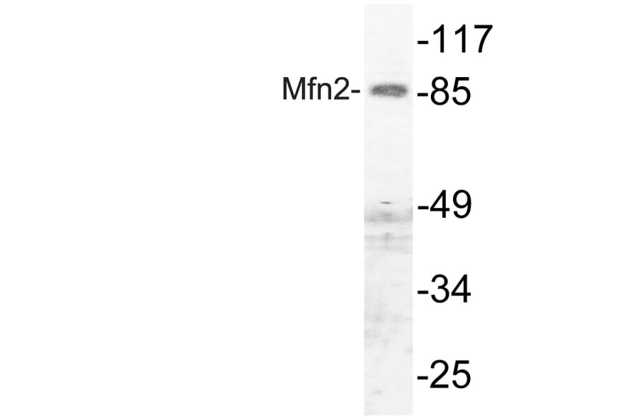 Western Blot - Anti-Mfn2 Antibody (R12-2237) - Antibodies.com