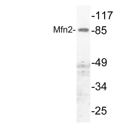 Western Blot - Anti-Mfn2 Antibody (R12-2237) - Antibodies.com