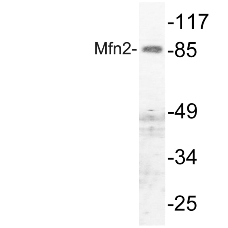 Western Blot - Anti-Mfn2 Antibody (R12-2237) - Antibodies.com