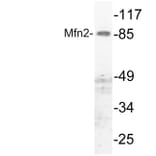 Western Blot - Anti-Mfn2 Antibody (R12-2237) - Antibodies.com