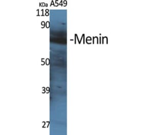 Western Blot - Anti-MEN1 Antibody (C13083) - Antibodies.com