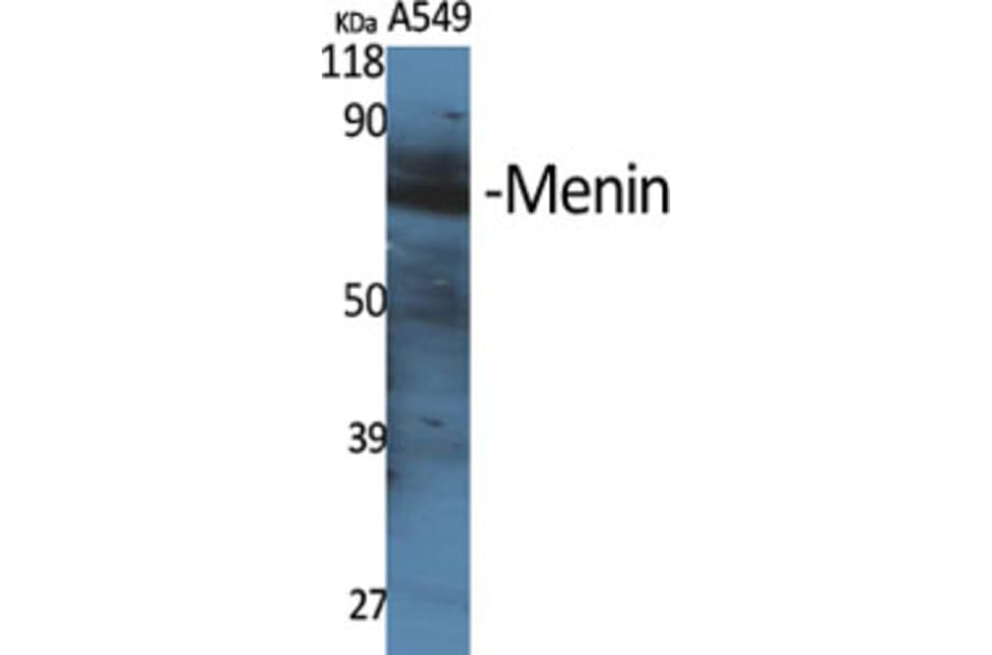 Western Blot - Anti-MEN1 Antibody (C13083) - Antibodies.com