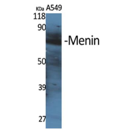 Western Blot - Anti-MEN1 Antibody (C13083) - Antibodies.com