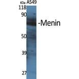 Western Blot - Anti-MEN1 Antibody (C13083) - Antibodies.com