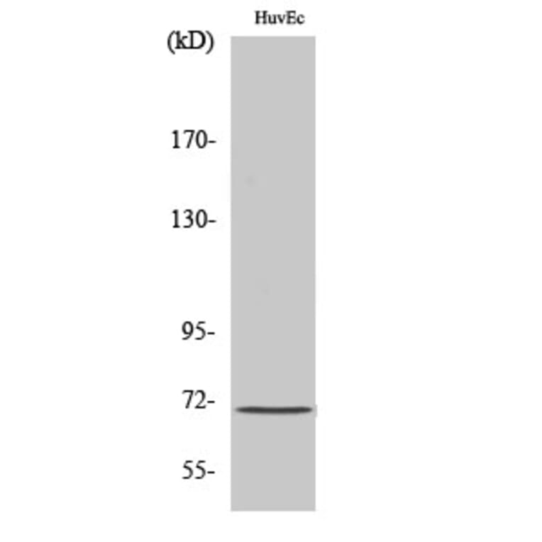 Western Blot - Anti-MEN1 Antibody (C13083) - Antibodies.com