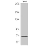 Western Blot - Anti-MEN1 Antibody (C13083) - Antibodies.com