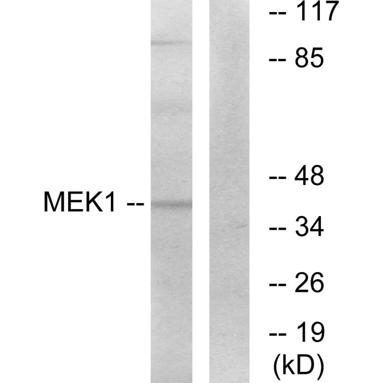 Western Blot - Anti-MEK1 Antibody (B7148) - Antibodies.com