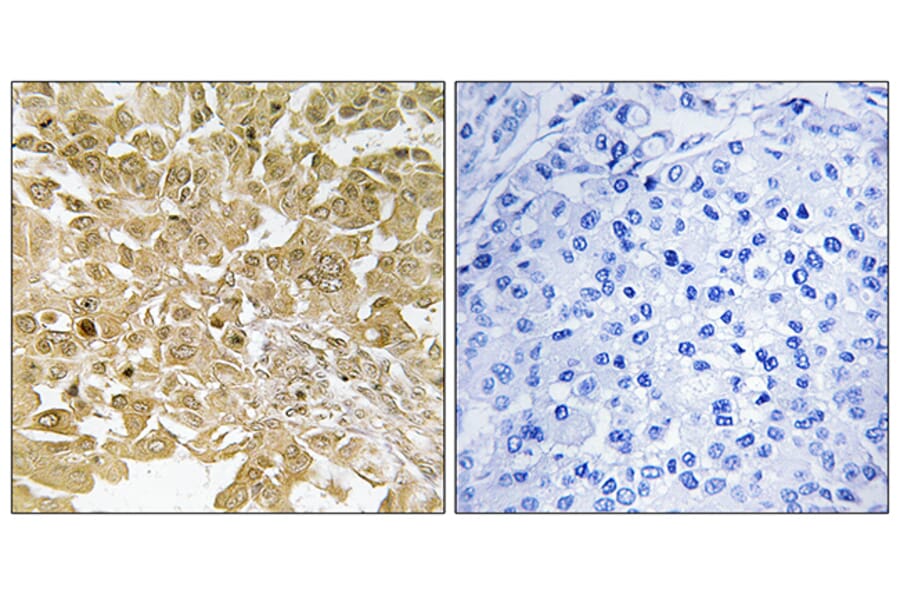 Immunohistochemistry - Anti-MEK1 Antibody (B7148) - Antibodies.com