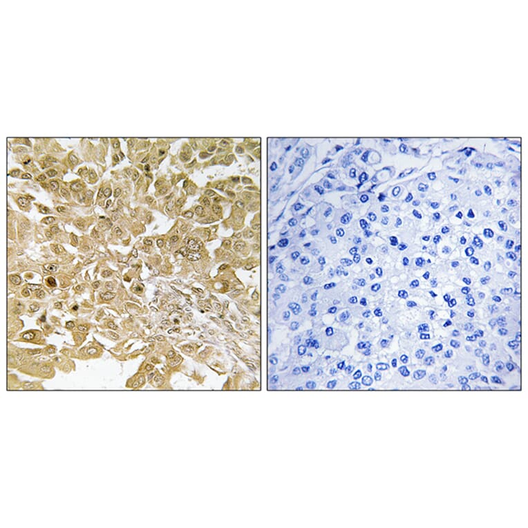 Immunohistochemistry - Anti-MEK1 Antibody (B7148) - Antibodies.com